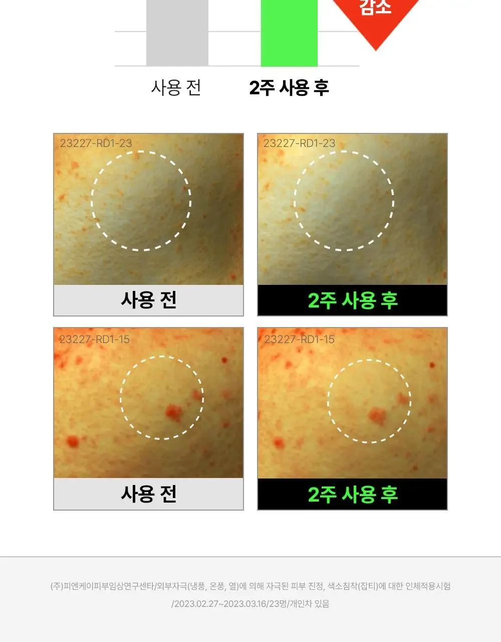 [트러블진정흔적] 파티온 노스카나인 트러블 바디 미스트 145ml 상세페이지 16